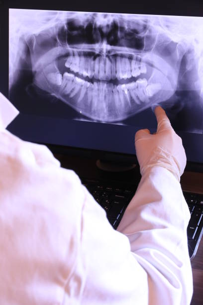 Best Emergency Dental Care for Abscessed Tooth in Martinez, GA
