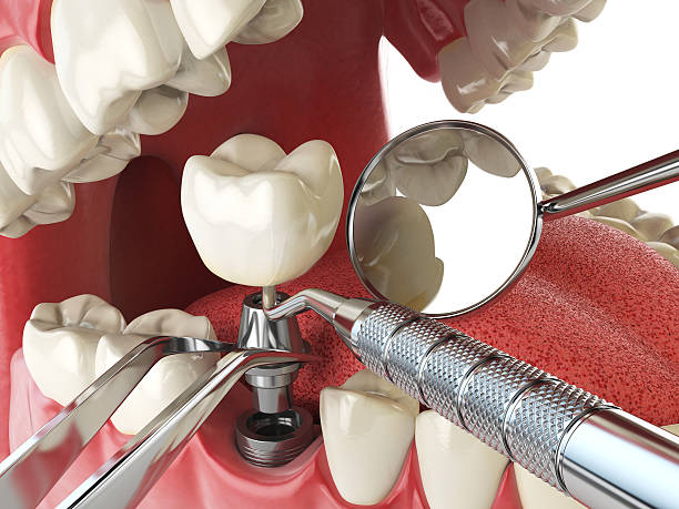 Best Broken or Cracked Tooth Emergency Dentist in Martinez, GA